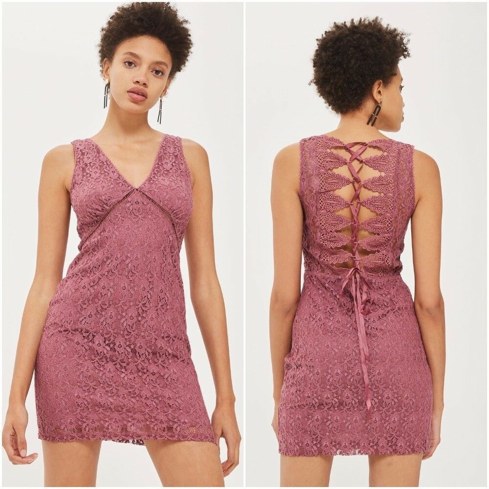 Lace Topshop Bodycon Dress